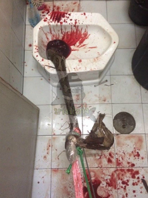 Homem é picado por cobra no pênis ao se 
sentar em vaso sanitário (Foto: Reprodução