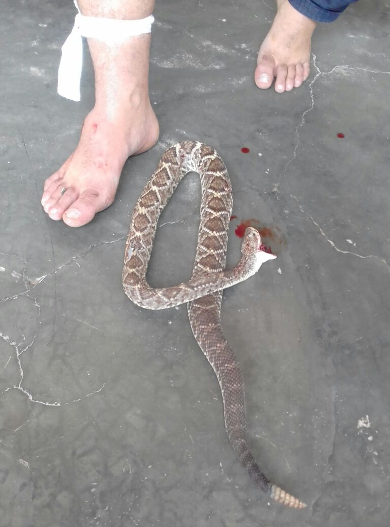Vereador de Juru foi picado por cascavel e matou cobra com mordida, no Sertão da Paraíba (Foto: Álvaro Teixeira/Arquivo Pessoal)