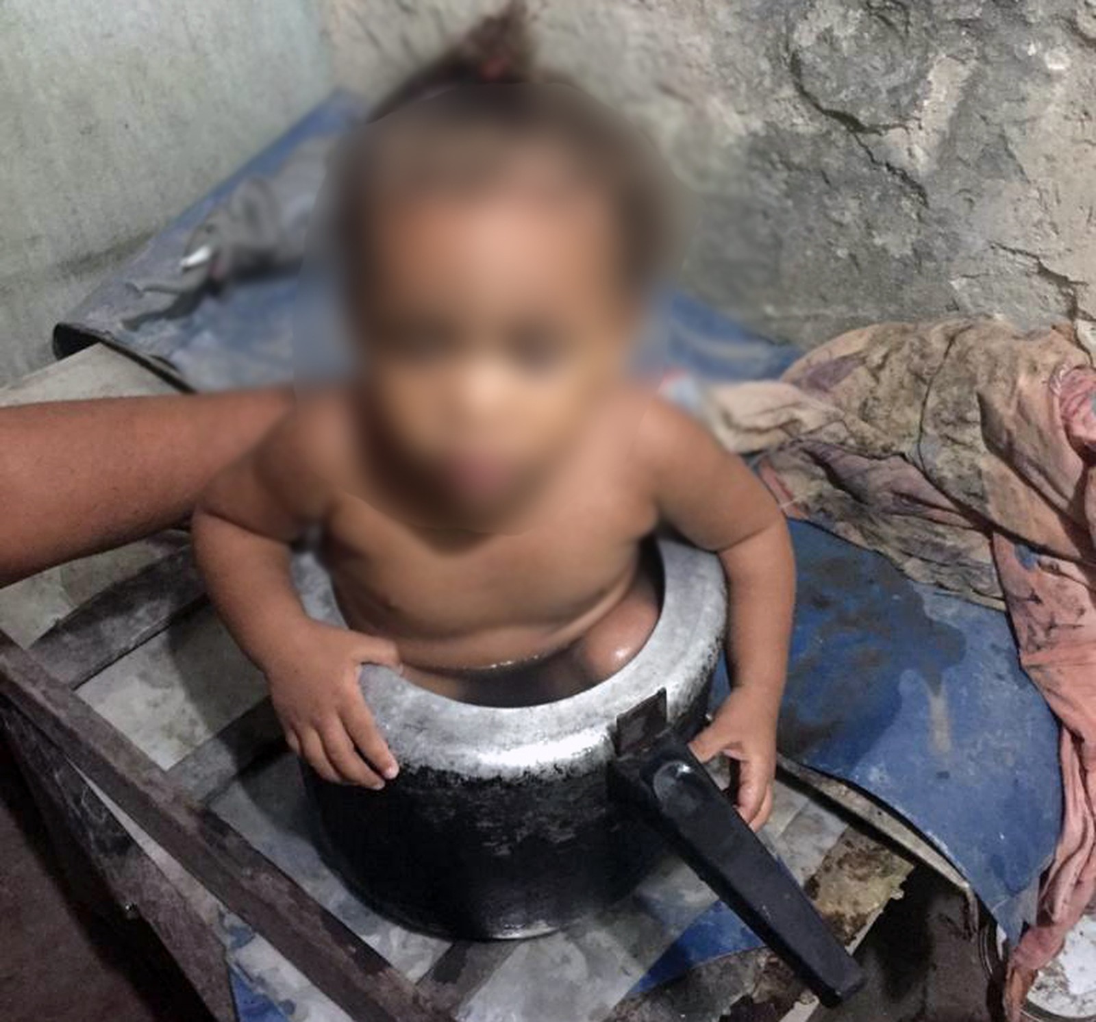 Criança entrou em panela de pressão e ficou presa em Goiana — Foto: Reprodução/WhatsApp